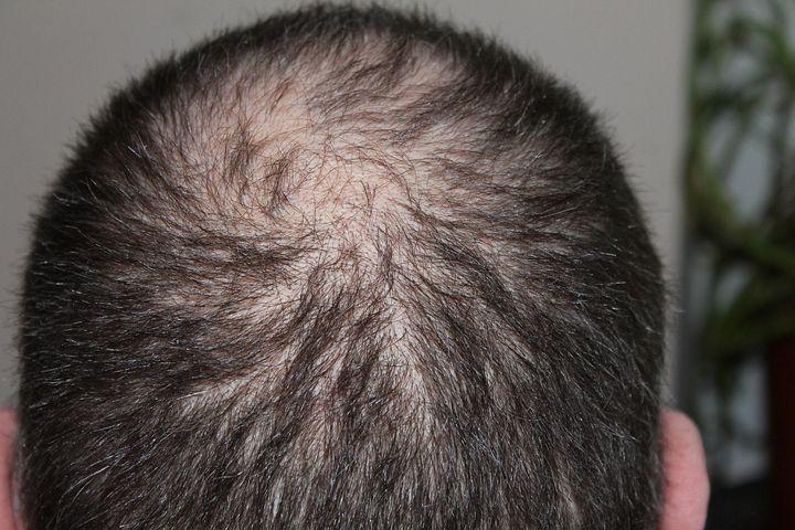 Why is My Hair Falling Out?' | Earth to Body Why is My Hair Falling Out?' | Earth to Body